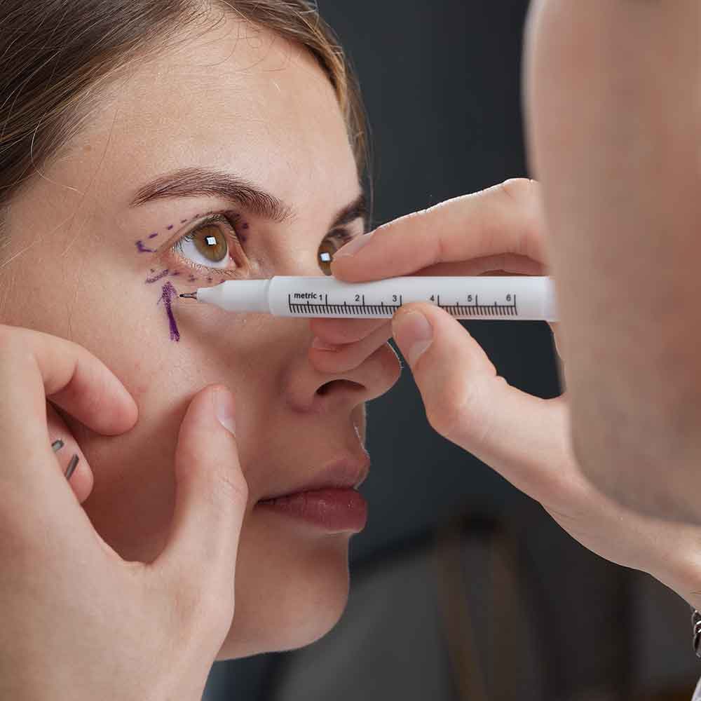 woman getting-prepared for eyelid surgery